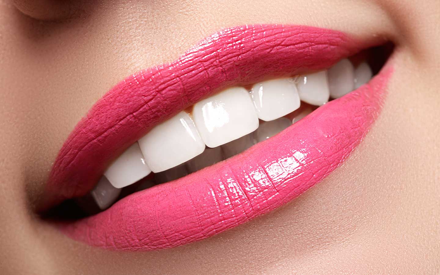Hollywood Smile 8 Image link