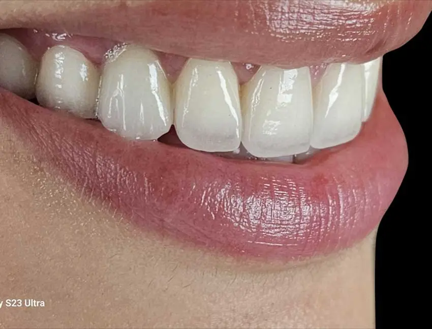 RU Landing 2027 15 Hollywood Smile