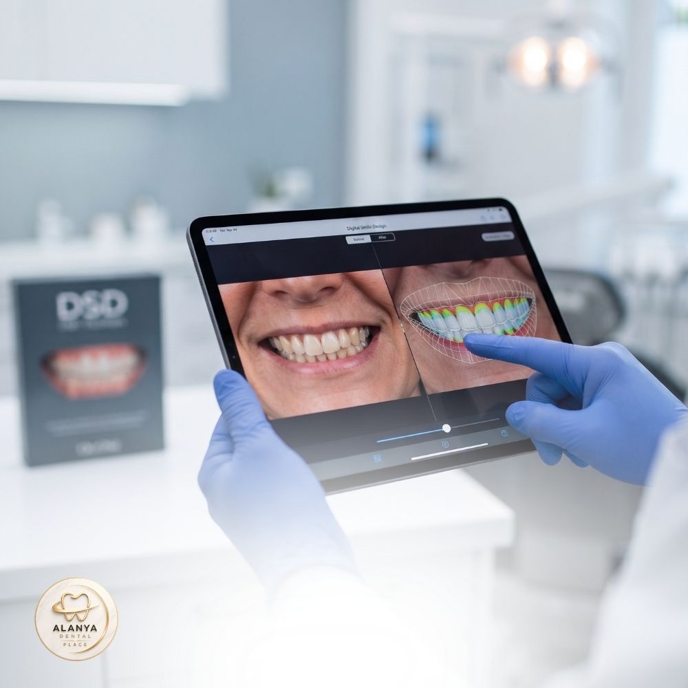 Hollywood Smile 9 Image link