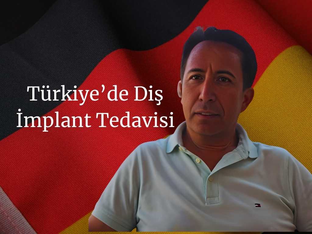 Hollywood Gülüşü 30 Image
