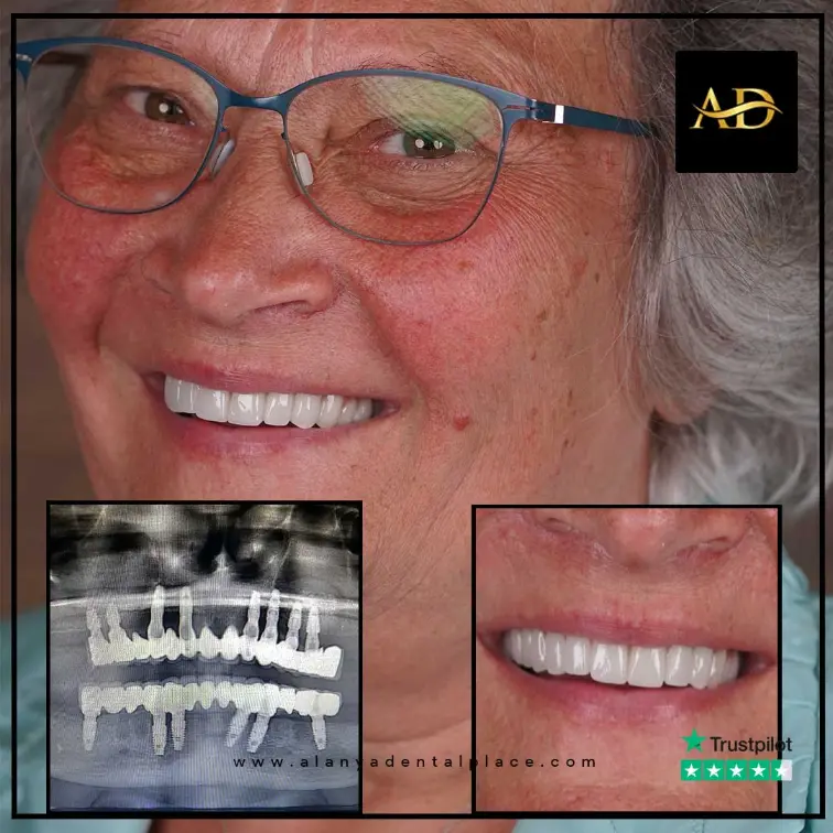 before after 1 2 2